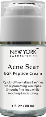 8 Best Acne Scar Treatments